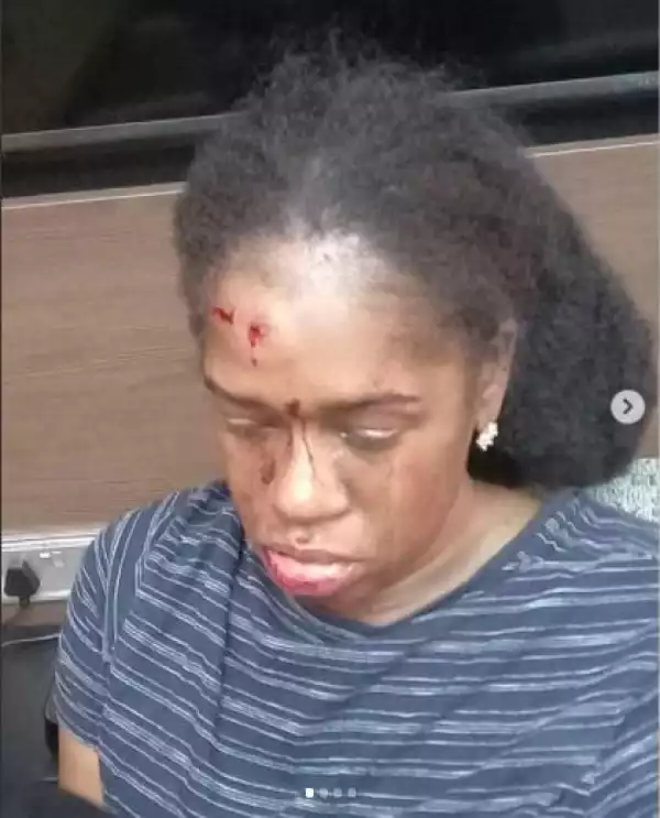 Nigerian OAP Calls For Justice After His Friend Was Allegedly Assaulted By An Uber Driver