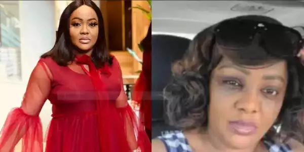 Fan Stirs Speculations About Domestic Violence In Helen Paul’s Marriage
