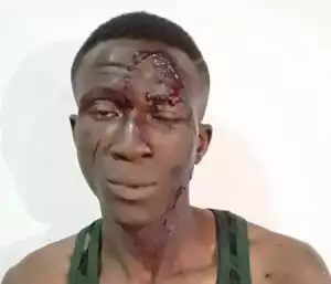 Police Arrest Notorious Armed Robber For Stabbing Victim Over iPhone in Abuja (Photo)