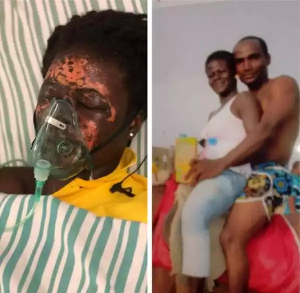 Ghanaian Man Bags 10 years In Jail For Pouring Acid On Wife
