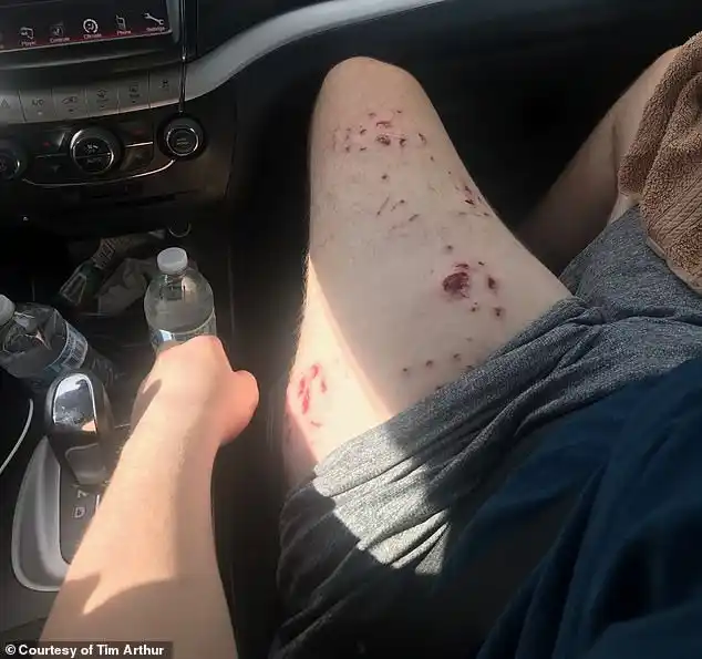 Boy, 16, survives a shark attack after his father repeatedly punched and kicked the five-foot predator (photos)