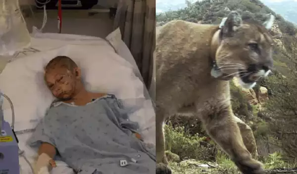 9-Year-Old Girl wakes up from coma after miraculously surviving rare Cougar attack