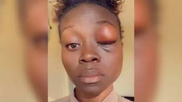 Nigerian Woman Brutalised By Canadian Police Officers Outside Shopping Mall