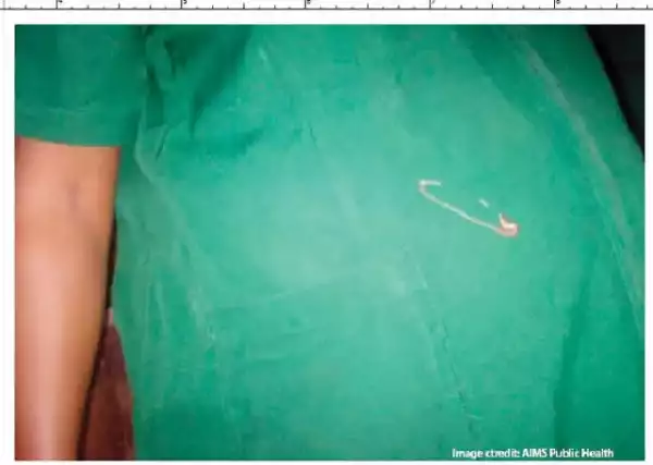 Why Do Pregnant Women Put Pins In Their Clothes?