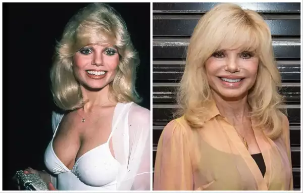 Age & Career Of Loni Anderson