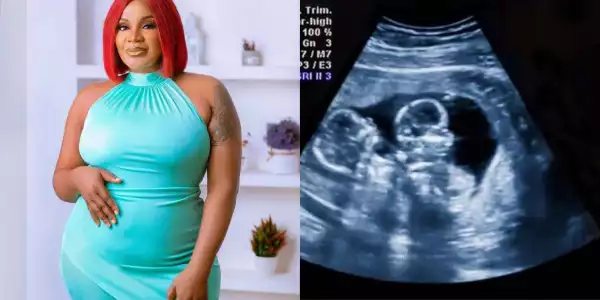 “Mama Ejima” Prayers pour in for Uche Ogbodo as she shares her ultrasound result