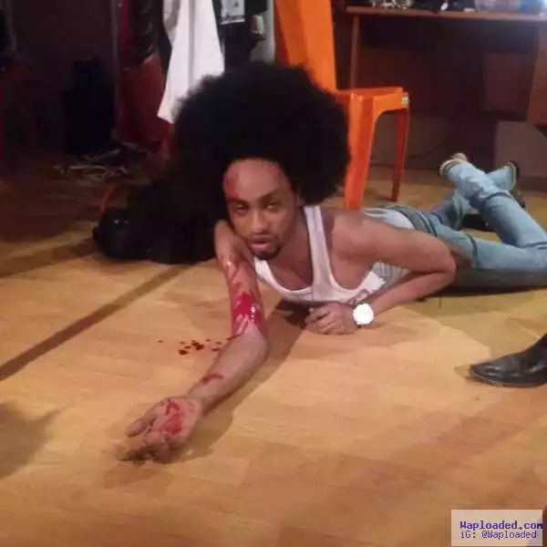 Photos: Denrele Falls & Injures While Shooting The Movie "Pepper Soup"